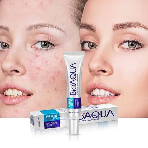 CREMA ANTIACNE BIOAQUA